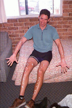 Fred's patented sunscreen application technique