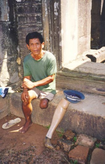 Mine-riddled Cambodia has more amputees than other place in the world